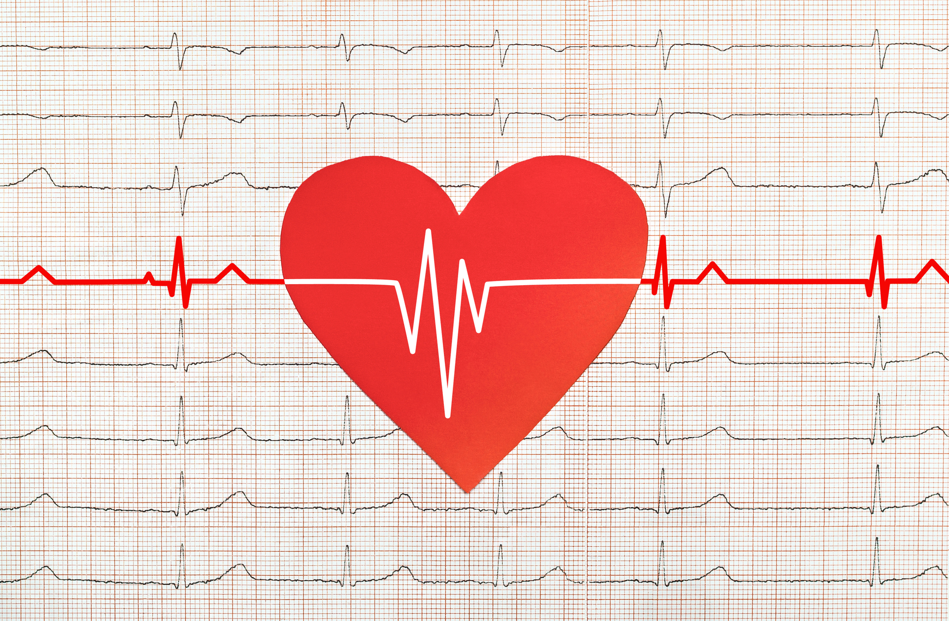 Dreamstime Xxl 95164301 6499ebde5e9bc