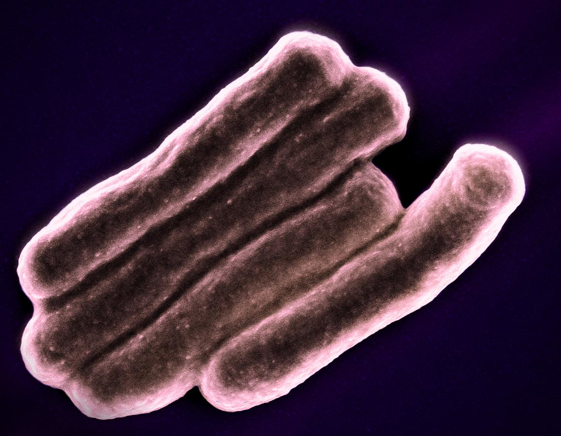 Scanning electron micrograph of Mycobacterium tuberculosis particles (colorized pink), the bacterium which causes TB. NIAID.