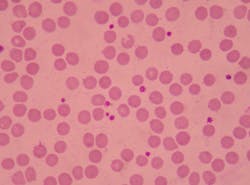 Dreamstime Xxl 120466771 64a588204831f Dreamstime Xxl 120466771 64a588204831f