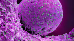 Colorized scanning electron micrograph of a cell (pink) infected with the Omicron strain of SARS-CoV-2 virus particles (teal), isolated from a patient sample. Image captured at the NIAID Integrated Research Facility (IRF) in Fort Detrick, Maryland. NIAID.