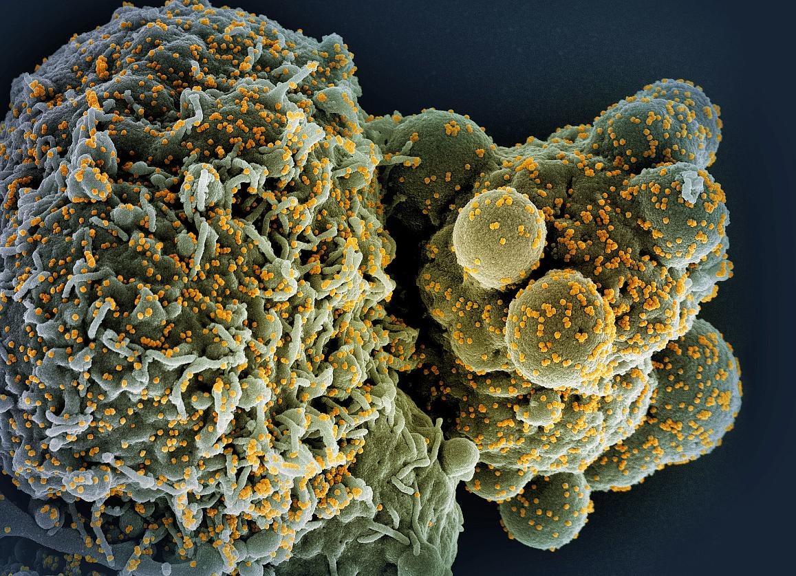 Colorized scanning electron micrograph of a cell (green) infected with the Omicron strain of SARS-CoV-2 virus particles (gold), isolated from a patient sample. NIAID.