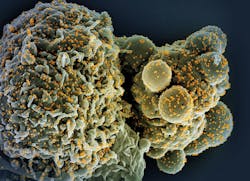 Colorized scanning electron micrograph of a cell (green) infected with the Omicron strain of SARS-CoV-2 virus particles (gold), isolated from a patient sample. NIAID. Colorized scanning electron micrograph of a cell (green) infected with the Omicron strain of SARS-CoV-2 virus particles (gold), isolated from a patient sample. NIAID.