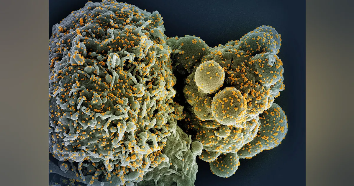 Baseimmune Severe COVID-19 may lead to long-term innate immune system changes ...