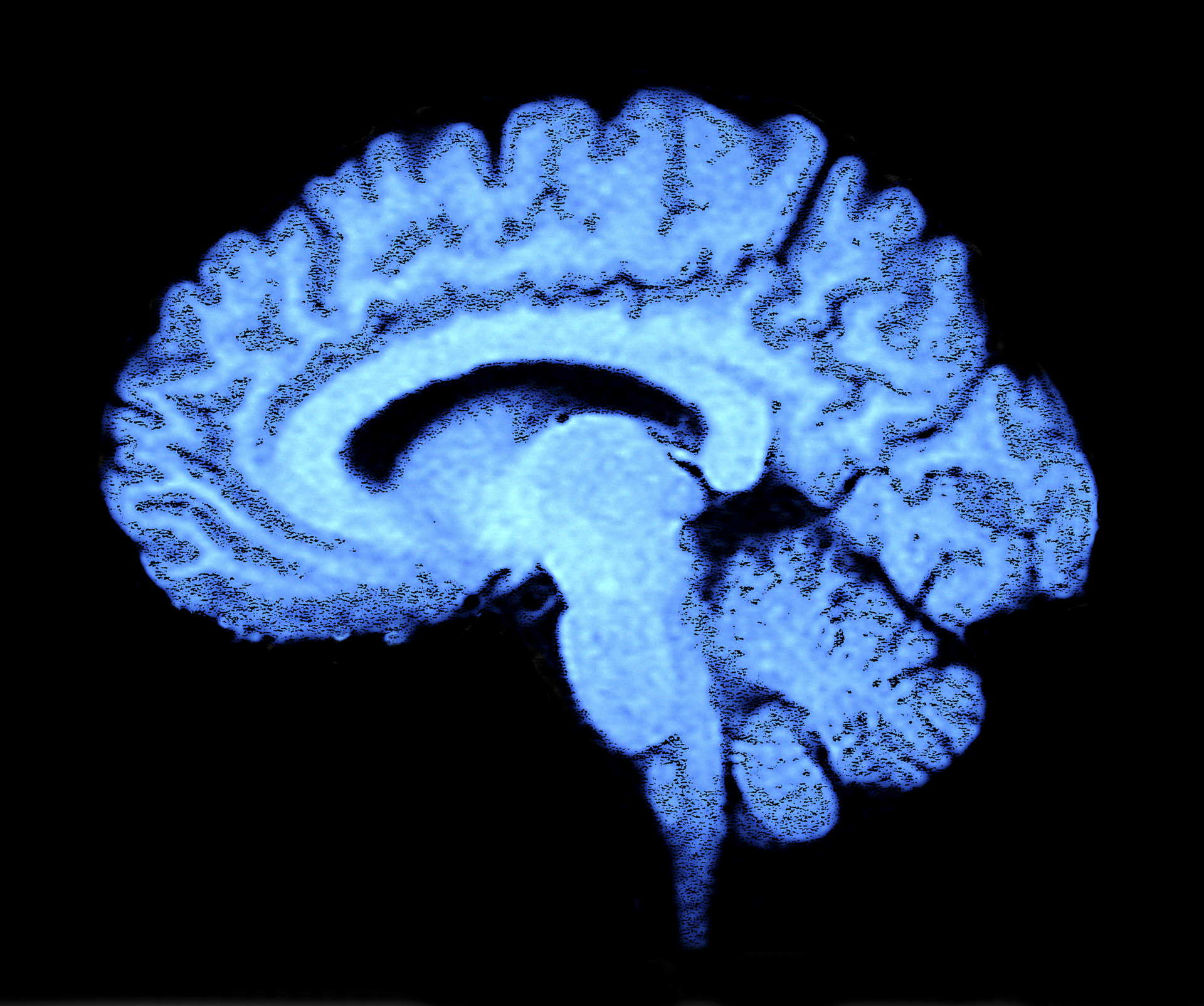 Dreamstime Xl 4963114 64ee0f4e24805