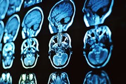 Dreamstime Xxl 133987929 64de392956566 Dreamstime Xxl 133987929 64de392956566