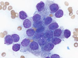 Dreamstime Xxl 281102383 64de3adf0bd46 Dreamstime Xxl 281102383 64de3adf0bd46