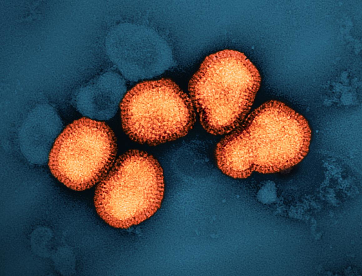 A colorized transmission electron micrograph of influenza A virus particles, colorized orange, isolated from a patient sample and then propagated in cell culture. NIAID.