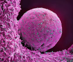 Colorized scanning electron micrograph of a cell (pink) infected with the Omicron strain of SARS-CoV-2 virus particles (teal), isolated from a patient sample. NIAID. Colorized scanning electron micrograph of a cell (pink) infected with the Omicron strain of SARS-CoV-2 virus particles (teal), isolated from a patient sample. NIAID.