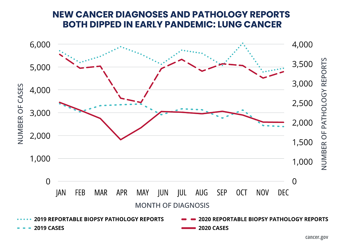 Lung cancer diagnoses fell from March 2020 to May 2020, one of six major cancer types to experience a dip during the early part of the pandemic. NCI.