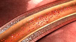 Dreamstime Xxl 73450097 6516eca257795 Dreamstime Xxl 73450097 6516eca257795