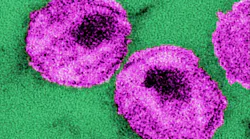 Courtesy of the CDC
