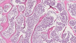 65451a9ebed091001e8e31c1 Machinelearningosteosarcoma 65451a9ebed091001e8e31c1 Machinelearningosteosarcoma