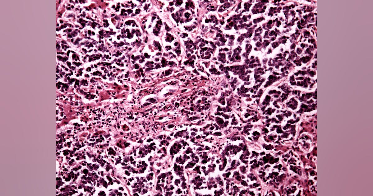 Automating tissue dissection key to personalized medicine | Medical ...