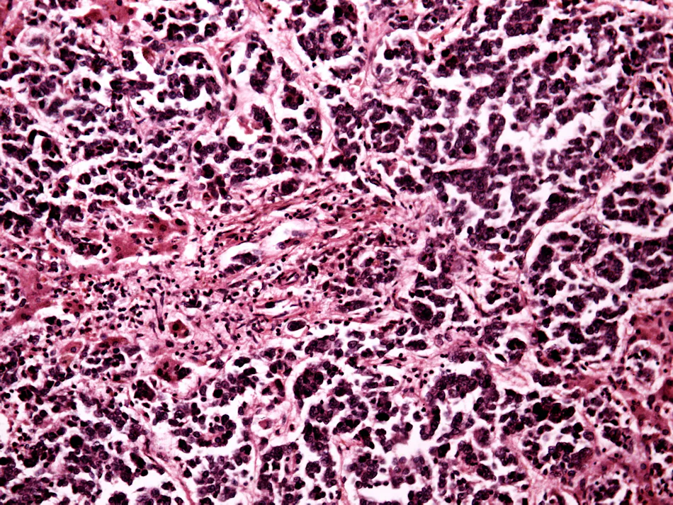Automating tissue dissection key to personalized medicine | Medical ...
