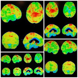 654bb0346bac49001e27f6d2 Dreamstime Xxl 73712058 654bb0346bac49001e27f6d2 Dreamstime Xxl 73712058