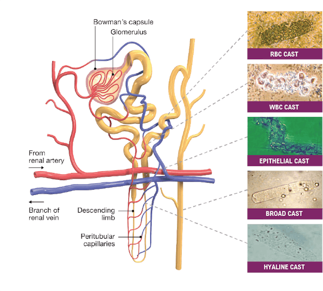 Figure 1: Microscopic images courtesy of Sorin G&icirc;ju, Ph.D., Clinical Emergency Hospital Timisoara, Romania.