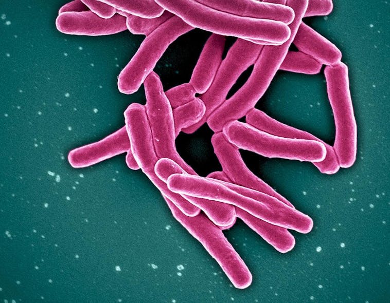 Mycobacterium Tuberculosis Bacteria, the Cause of TB. NIAID.