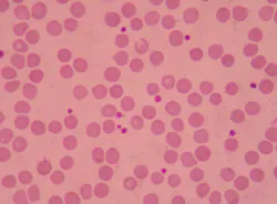 65785dd314596a001e2d785c Dreamstime Xxl 120466771 1 65785dd314596a001e2d785c Dreamstime Xxl 120466771 1