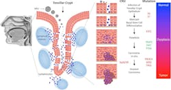 Figure 1: The initiation of HPV infection and subsequent tumorigenesis in cells of the tonsillar crypt.6 Figure 1: The initiation of HPV infection and subsequent tumorigenesis in cells of the tonsillar crypt.6
