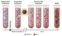 Figure 2: HIV viral load and CD4 cell count as HIV progresses.18