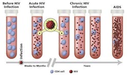 Figure 2: HIV viral load and CD4 cell count as HIV progresses.18 Figure 2: HIV viral load and CD4 cell count as HIV progresses.18