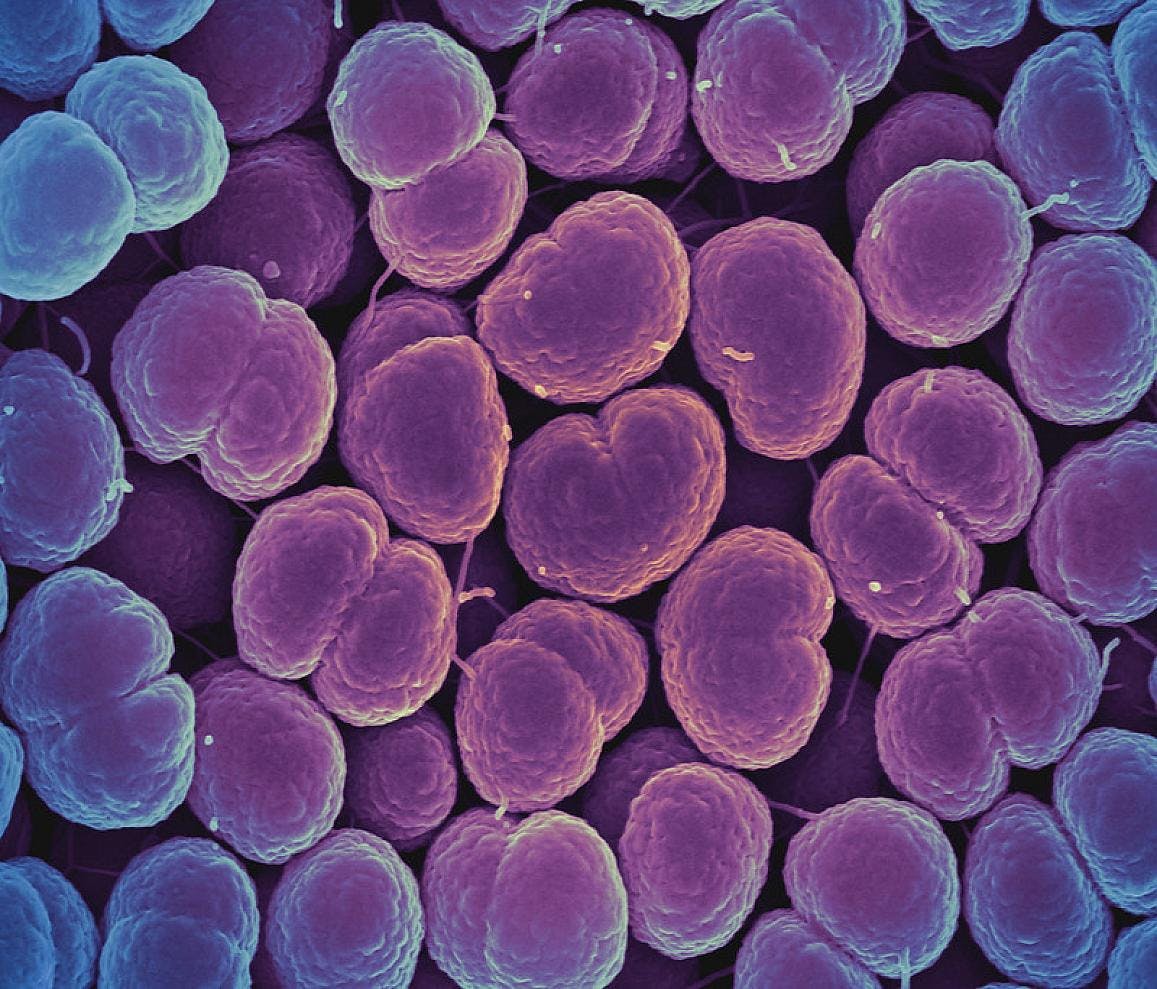 Scanning electron micrograph of Neisseria gonorrhoeae bacteria, which causes gonorrhea. Captured by the Research Technologies Branch (RTB) at the NIAID Rocky Mountain Laboratories (RML) in Hamilton, Montana. NIAID.