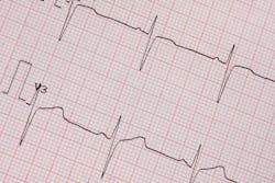 6596d316a89e42001e438f91 Dreamstime Xxl 30337068 6596d316a89e42001e438f91 Dreamstime Xxl 30337068