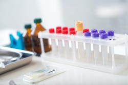 659ec4d7faca1f001d9c2260 Dreamstime Xxl 80208536 659ec4d7faca1f001d9c2260 Dreamstime Xxl 80208536