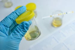 65b9173cf6344a001eb55296 Dreamstime Xxl 54807494 1 65b9173cf6344a001eb55296 Dreamstime Xxl 54807494 1