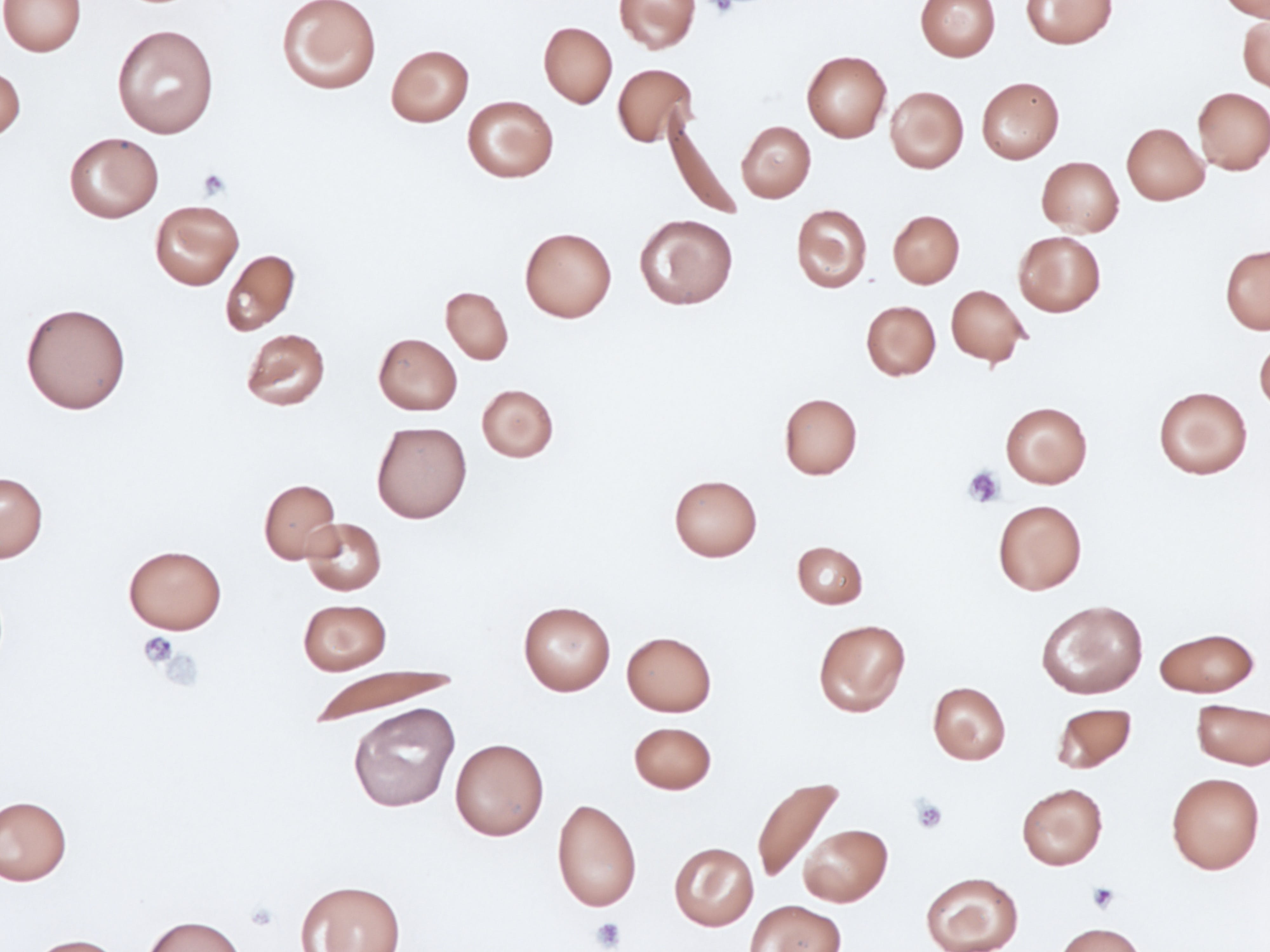 65bbbda26a824a001eeddd33 Dreamstime Xxl 280878453 1