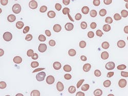 65bbbda26a824a001eeddd33 Dreamstime Xxl 280878453 1 65bbbda26a824a001eeddd33 Dreamstime Xxl 280878453 1