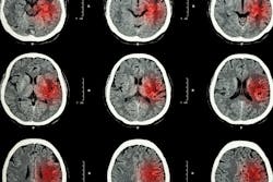 65d4c8a61fa8bd001f562449 Dreamstime Xxl 55255264 65d4c8a61fa8bd001f562449 Dreamstime Xxl 55255264