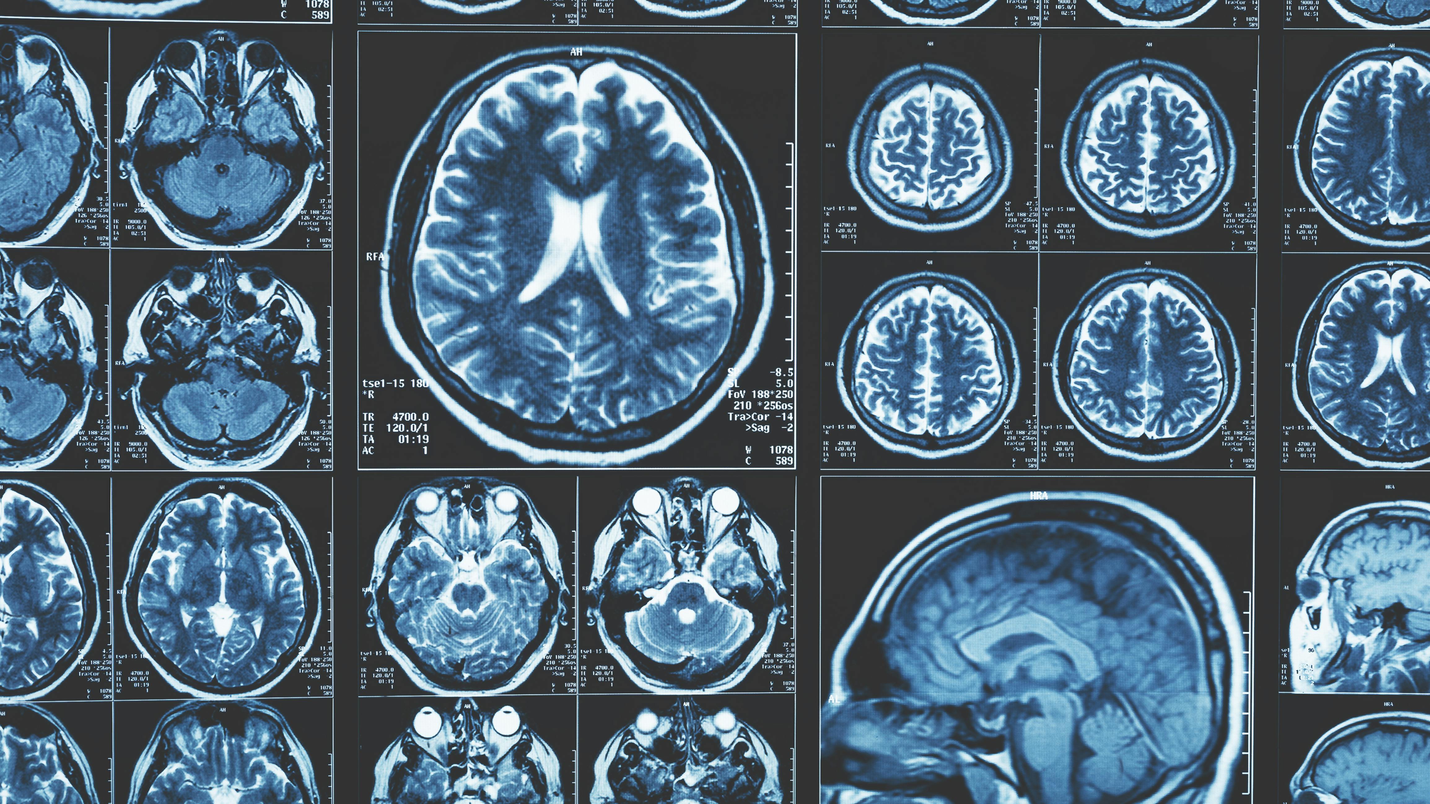 65d75ee268a7e9001e9f76f0 Dreamstime Xxl 113188023