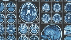 65d75ee268a7e9001e9f76f0 Dreamstime Xxl 113188023 65d75ee268a7e9001e9f76f0 Dreamstime Xxl 113188023