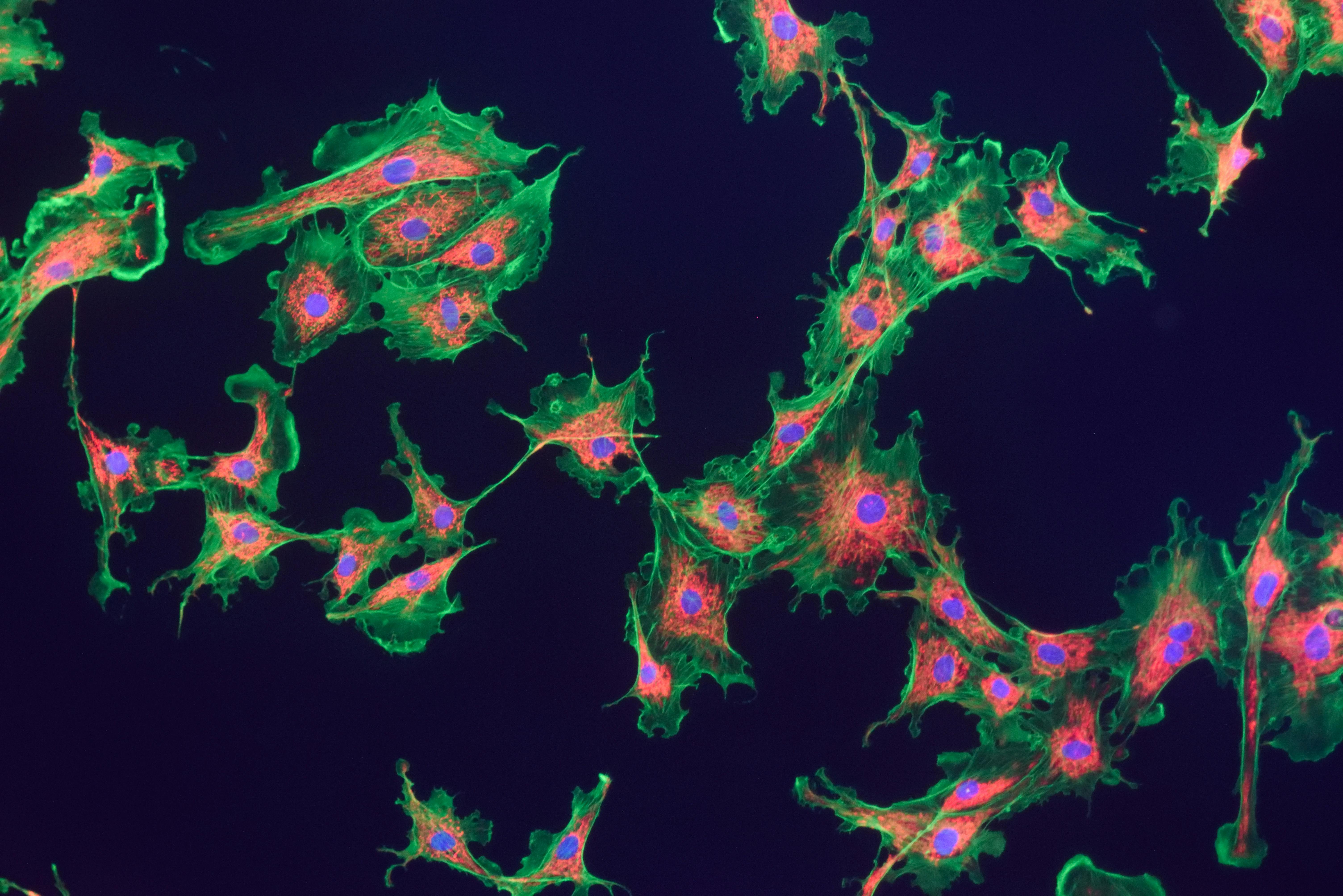 65d8b1c638a238001e8b0ffb Dreamstime Xxl 47622233