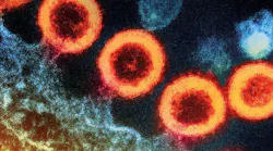 Transmission electron micrograph of HIV-1 virus particles (orange) replicating from the plasma membrane of an infected H9 T cell. NIAID.