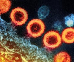 Transmission electron micrograph of HIV-1 virus particles (orange) replicating from the plasma membrane of an infected H9 T cell. NIAID.