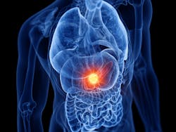 65ddfdc707d062001fc5e342 Adobestock 282277535 65ddfdc707d062001fc5e342 Adobestock 282277535