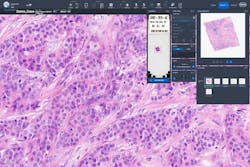 Figure 1: Scanned H&E image for primary diagnosis, or comparison with IHC and/or special stains. Figure 1: Scanned H&E image for primary diagnosis, or comparison with IHC and/or special stains.
