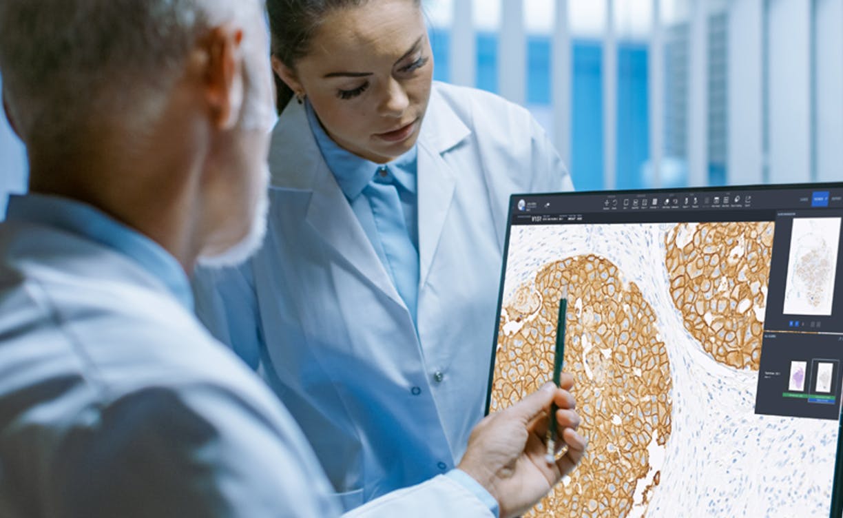 Figure 4: Review of immunohistochemistry using digital pathology software.