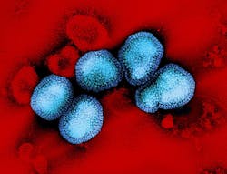 Colorized transmission electron micrograph of influenza A virus particles. NIAID.