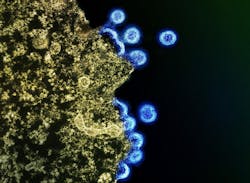 Transmission electron micrograph of HIV-1 virus particles (blue) replicating from the plasma membrane of an H9 T cell (yellow). NIAID. Transmission electron micrograph of HIV-1 virus particles (blue) replicating from the plasma membrane of an H9 T cell (yellow). NIAID.