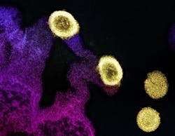 Transmission electron micrograph of HIV-1 virus particles (yellow) replicating from the plasma membrane of an H9 T cell (purple and pink). NIAID. Transmission electron micrograph of HIV-1 virus particles (yellow) replicating from the plasma membrane of an H9 T cell (purple and pink). NIAID.