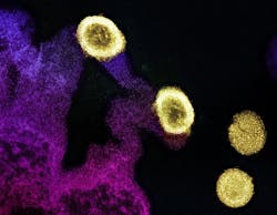 Transmission electron micrograph of HIV-1 virus particles (yellow) replicating from the plasma membrane of an H9 T cell (purple and pink). NIAID.