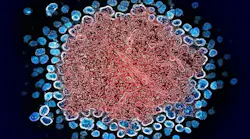 Colorized transmission electron micrograph of numerous HIV-1 virus particles (blue) replicating from a segment of a chronically infected H9 T cell (red). NIAID.