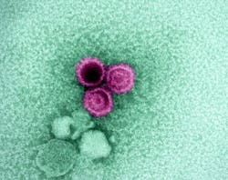 An electron micrograph showing three Epstein-Barr virus (EBV) particles colorized pink. NIAID. An electron micrograph showing three Epstein-Barr virus (EBV) particles colorized pink. NIAID.