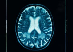 65fafc3c382916001f518f1b Dreamstime Xxl 25818065 65fafc3c382916001f518f1b Dreamstime Xxl 25818065