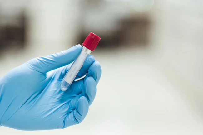 dreamstime_xxl_147116340