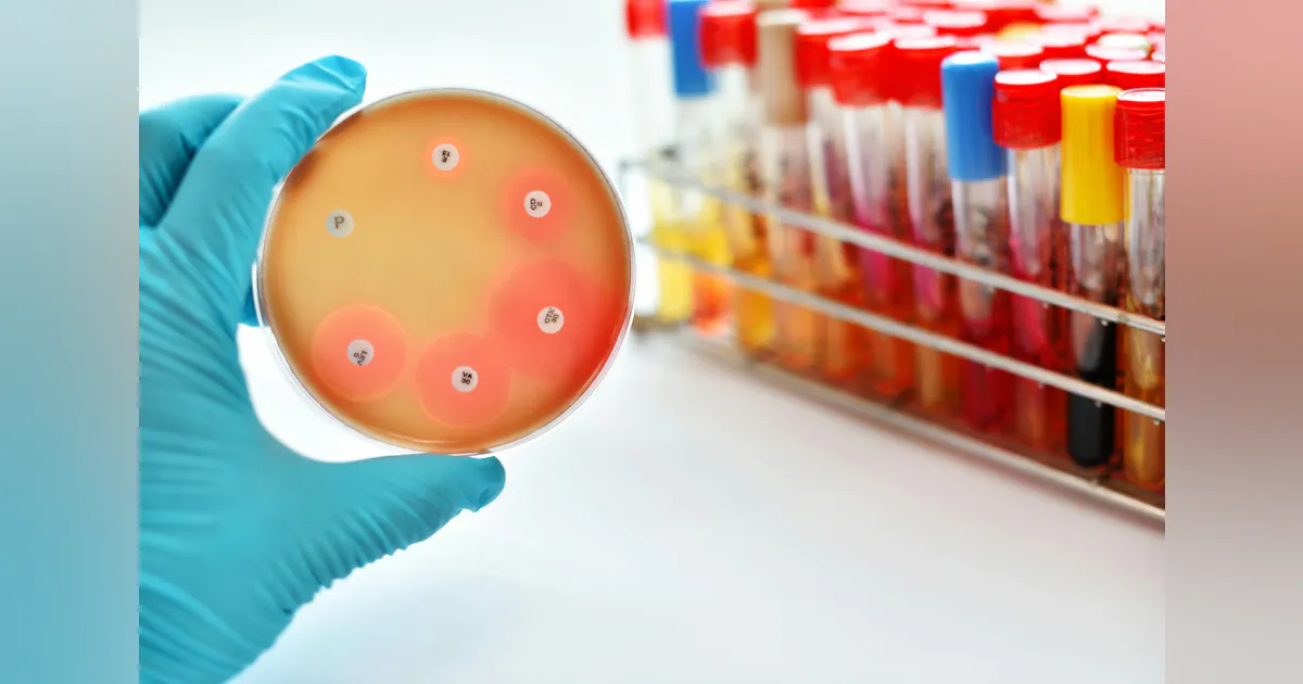 Clsi Ast Testing New updated CLSI AST guidance | MLO Online