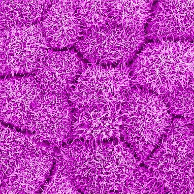 A top-down view of lab-grown RPE cells as seen with high-resolution microscopy. Unlike AO-OCT, which is performed in an awake person, this image was created with preserved tissue. NEI.